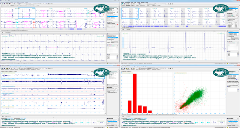 Анализ записи ЭКГ с применением программного обеспечения на рабочей станции