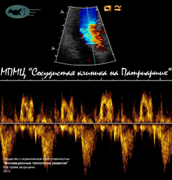 Сердце Сердце_2