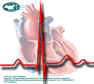 ECG2.png