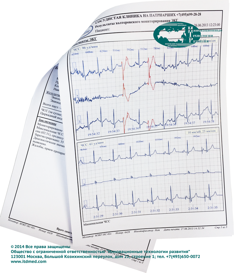 Протокол и заключение специалиста по результатам холтеровского мониторирования ЭКГ в МПМЦ "Сосудистая клиника на Патриарших"