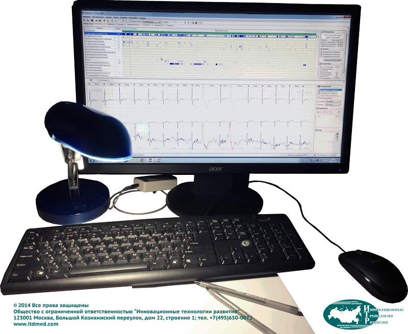 Рабочая станция с программным обеспечением "ДМС Передовые Системы" для анализа записи ЭКГ